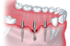 team of expert dentists