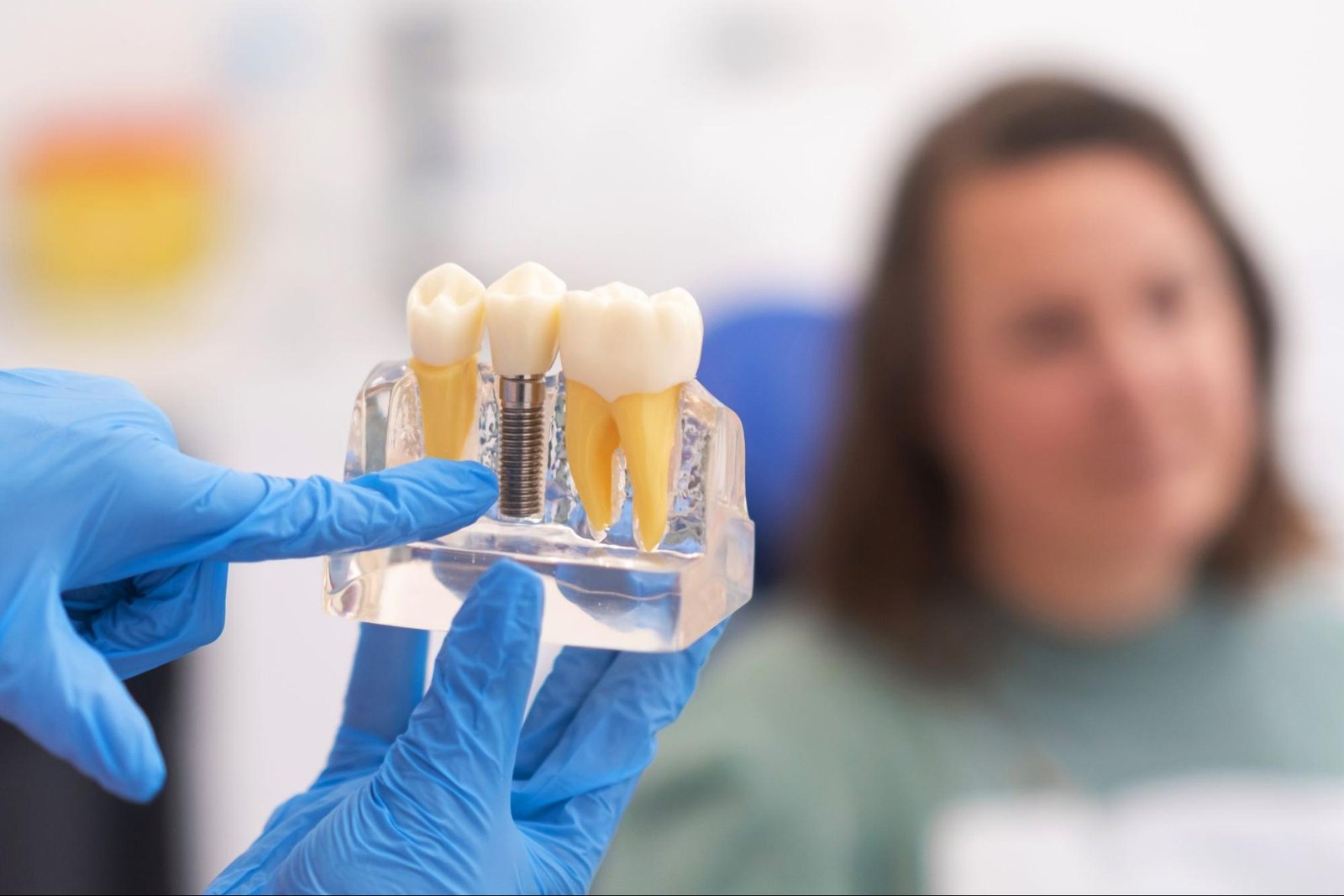 Pros-and-Cons-of- Implants