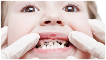 pediatric dentist ahmedabad