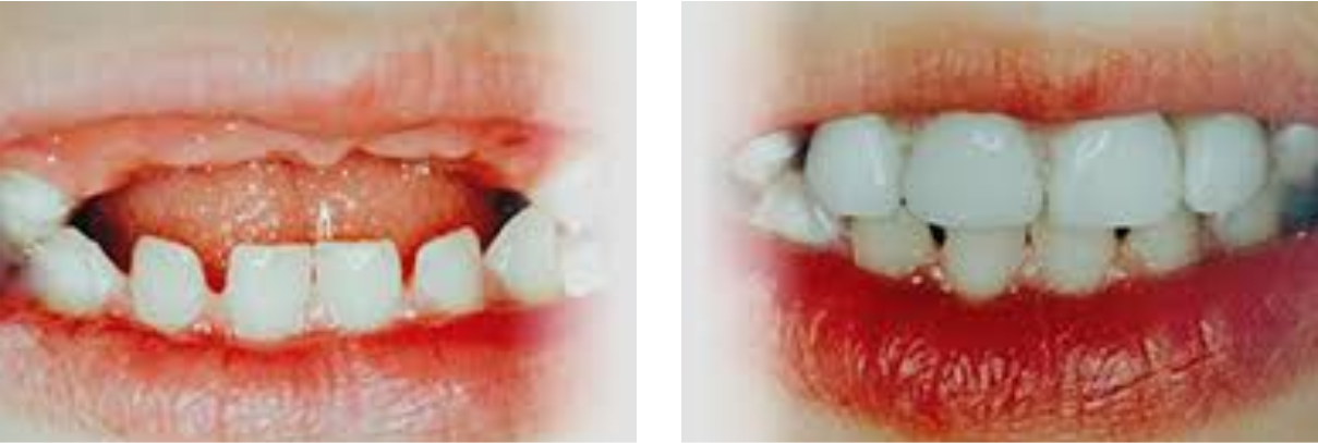 paediatric Before/After