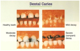 paediatric dentist