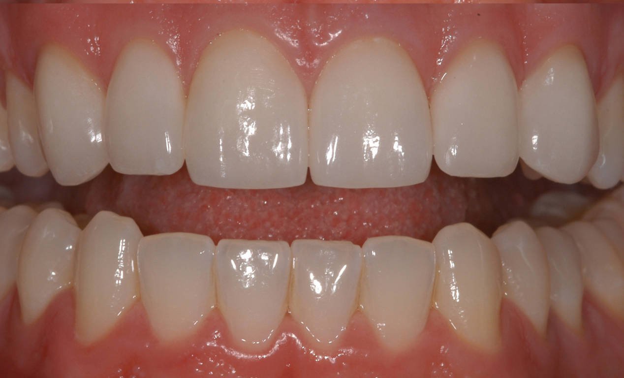 cosmetic dentistry ahmedabad