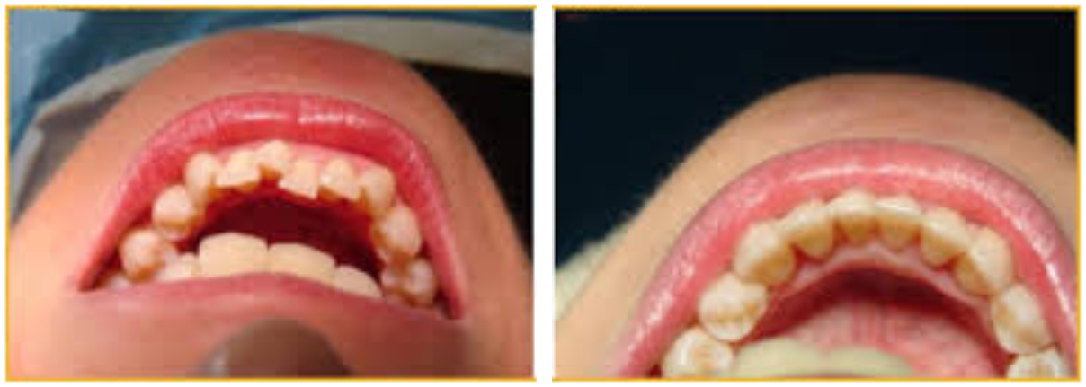 orthodontist treatments After