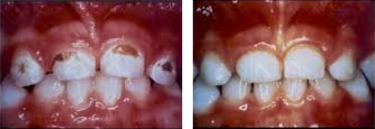 child-dental-care4_pre1