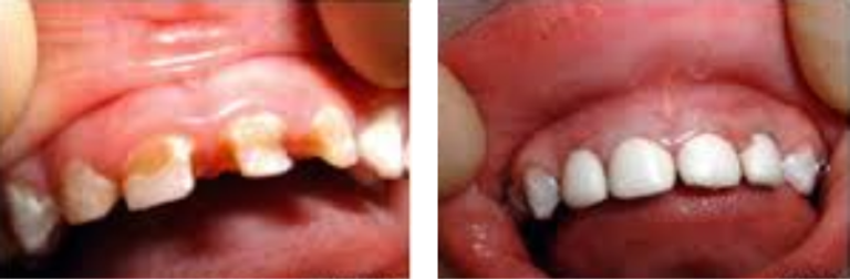 child-dental-care4_pre2