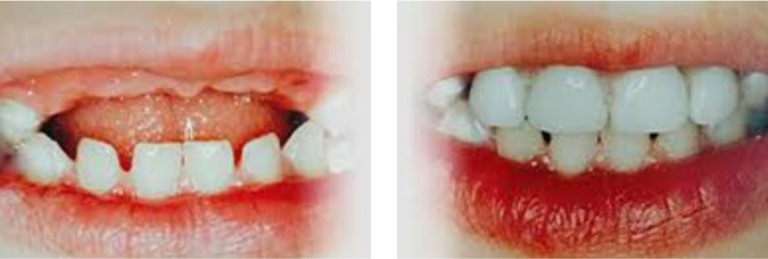 child-dental-care4_pre3