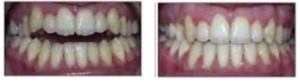orthodontic-pre1