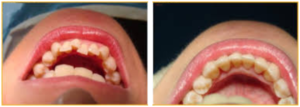 orthodontic-pre21