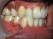 orthodontic-treatment-post3