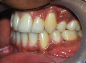 orthodontic-treatment-post5